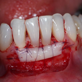 formation_endodontie_omnipratique