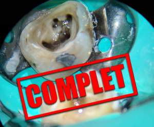 endodontie_complet